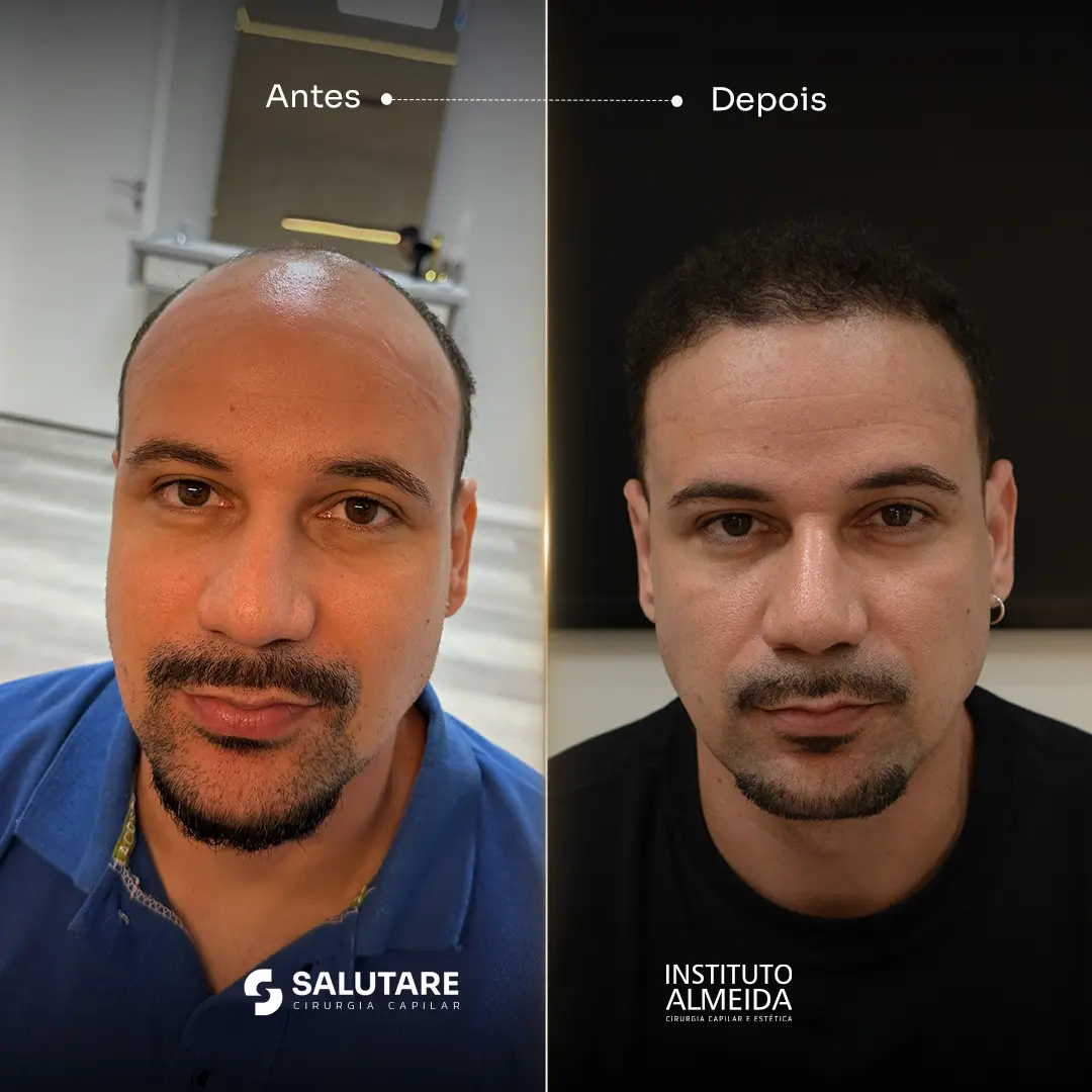 Criativo 2