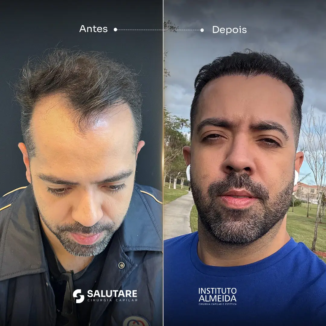 Criativo 25