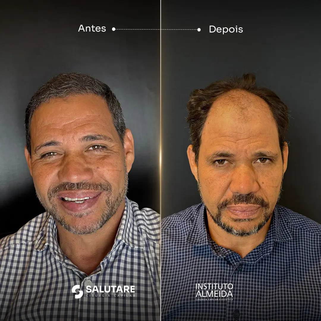 Criativo 30
