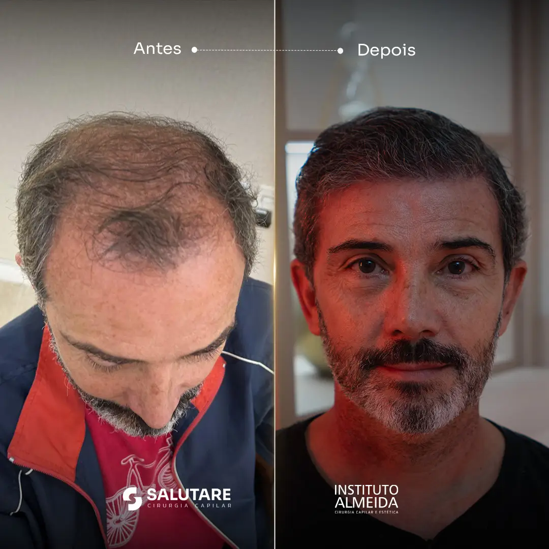 Criativo 4